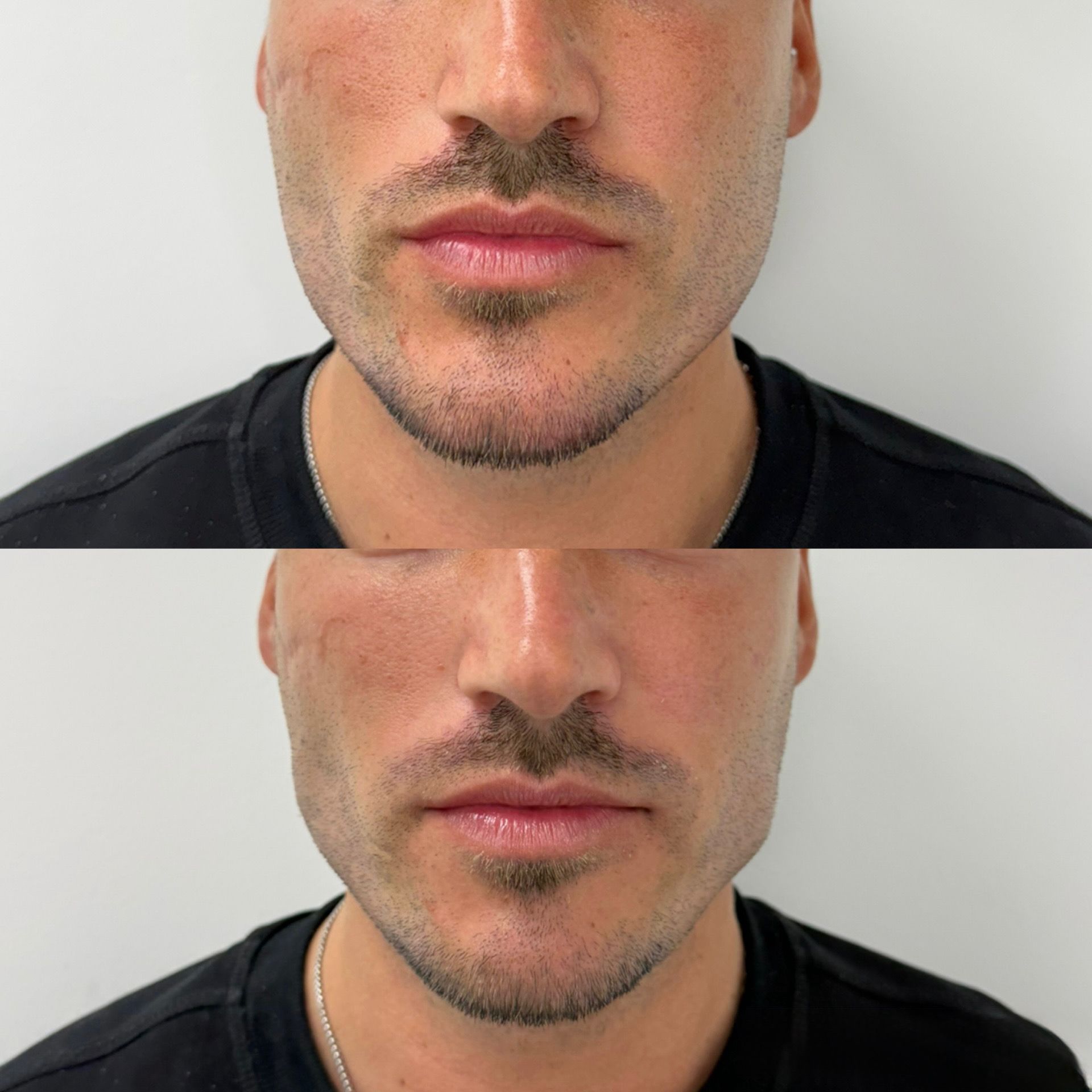 Mascul Facial 1