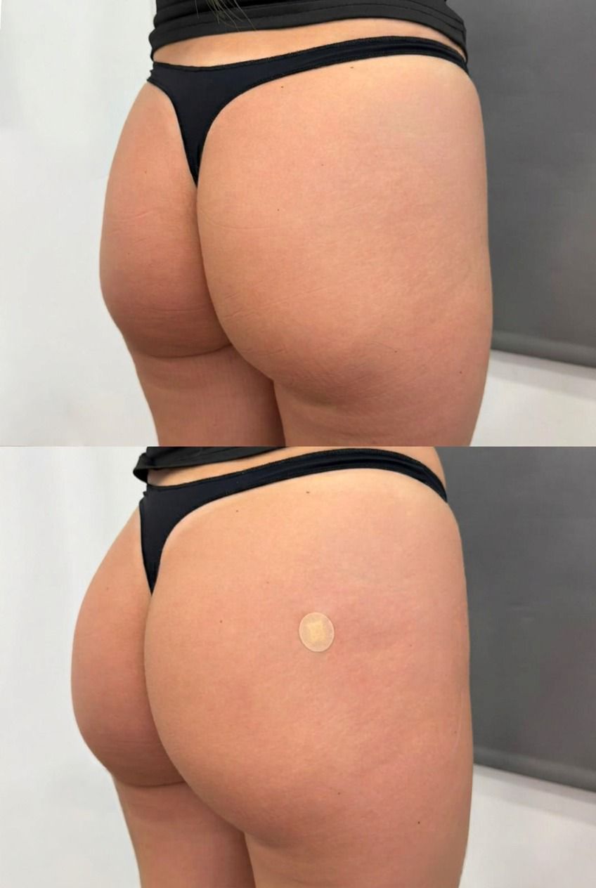 gluteos mujer 1